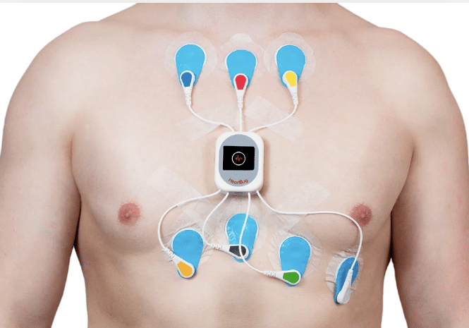 holter ekg