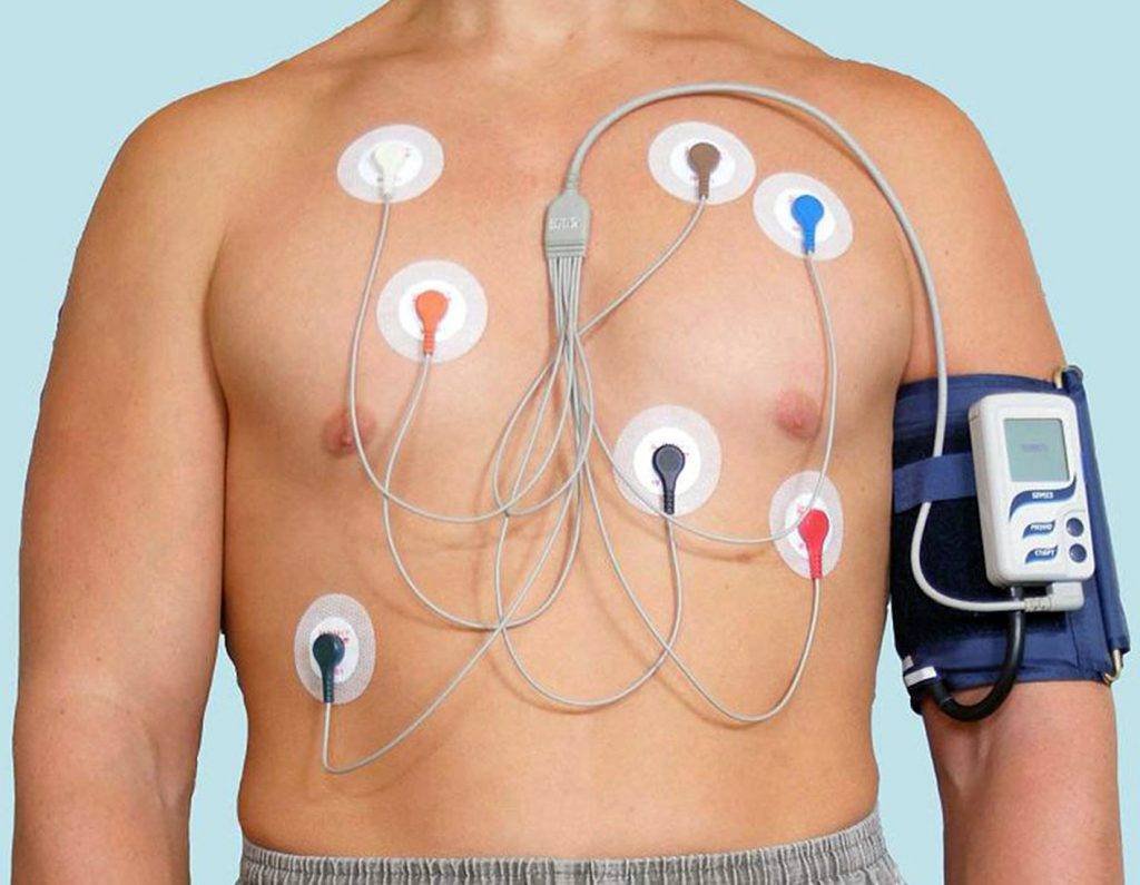holter ekg 2